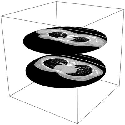 k-Nearest Neighbor Curves in Imaging Data Classification